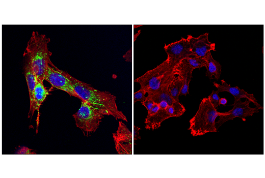 Immunofluorescence Image 1: Fibronectin/FN1 (E5H6X) Rabbit mAb (BSA and Azide Free)
