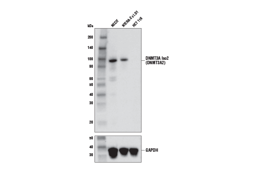  Image 3: DNMT3A Antibody Sampler Kit
