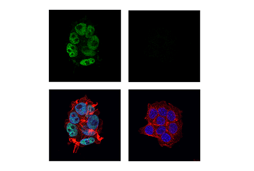 Immunofluorescence Image 1: DNMT3A Isoform 2 (E1Y5O) Rabbit mAb