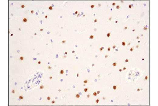 Immunohistochemistry Image 1: CHD5 (D2F9Q) Rabbit mAb