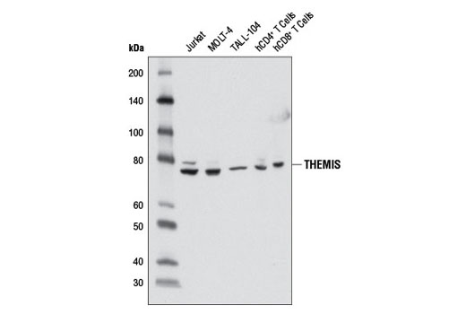 Western Blotting Image 1: THEMIS Antibody