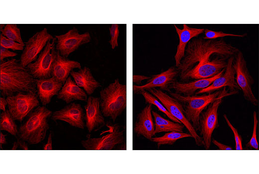 Immunofluorescence Image 1: Acetyl-Histone H3 (Lys9) (C5B11) Rabbit mAb (Alexa Fluor® 647 Conjugate)