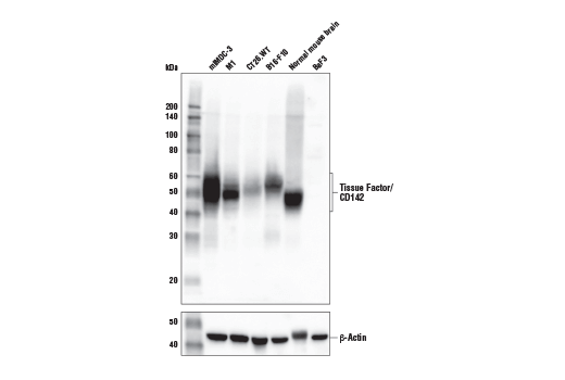 Western Blotting Image 1: Tissue Factor/CD142 (E2L3B) Rabbit mAb (Mouse Specific)