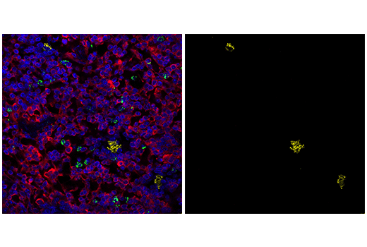 Immunofluorescence Image 1: Perforin (E9F7N) Rabbit mAb