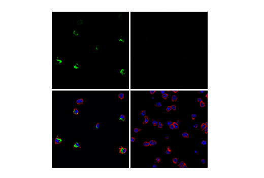 Immunofluorescence Image 2: Perforin (E9F7N) Rabbit mAb