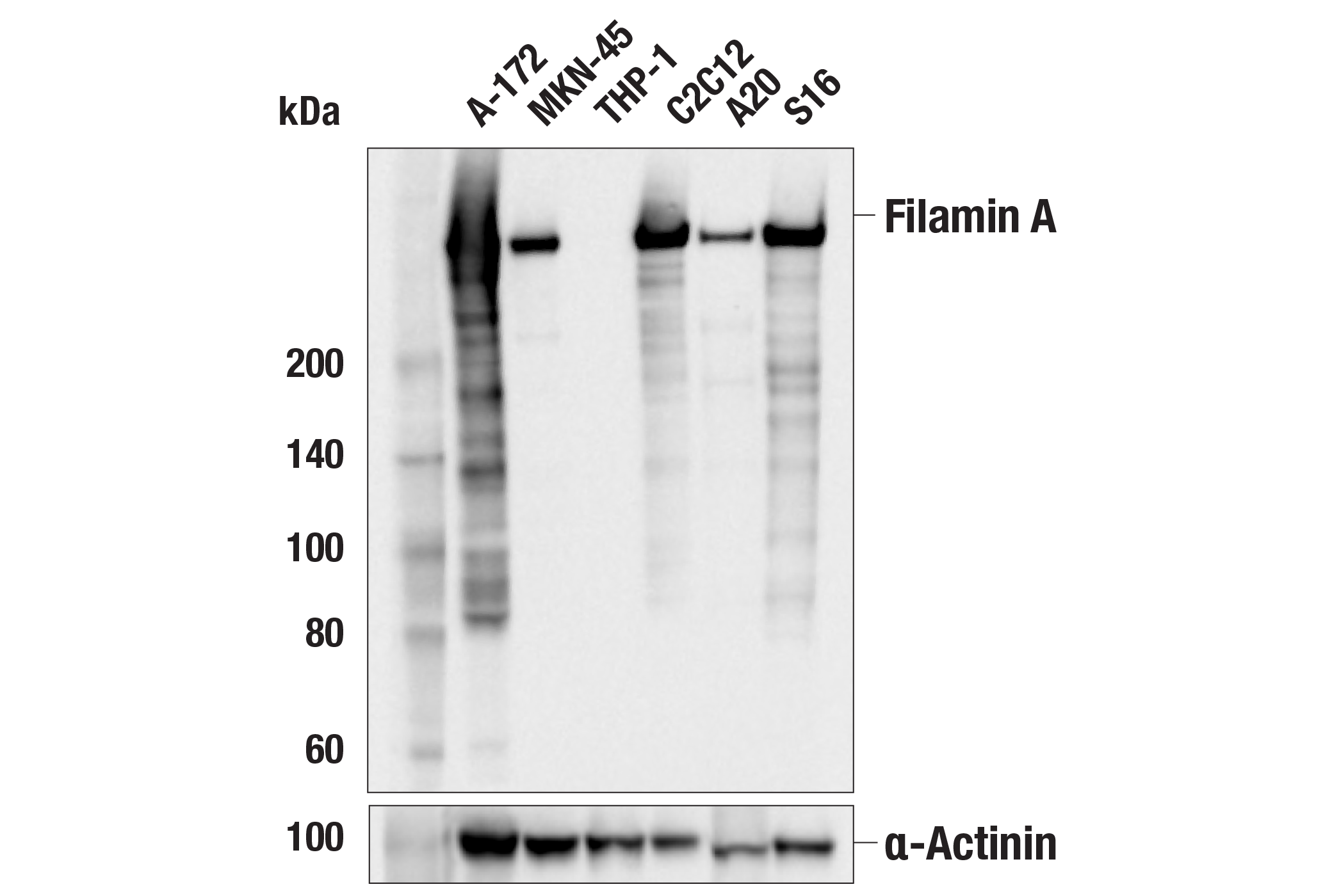 Western Blotting Image 1: Filamin A (E8P8M) Rabbit mAb
