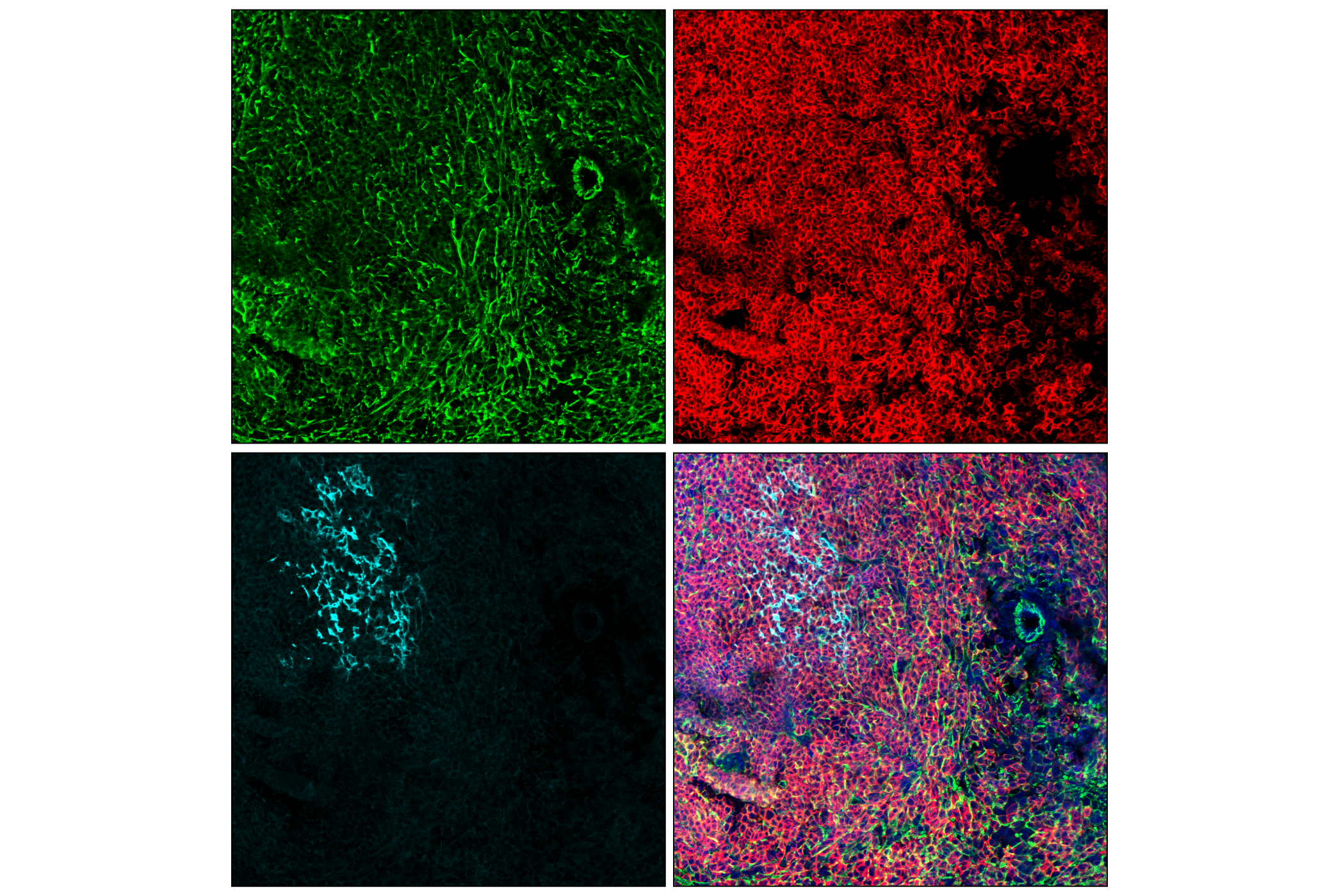 Immunofluorescence Image 2: Filamin A (E8P8M) Rabbit mAb