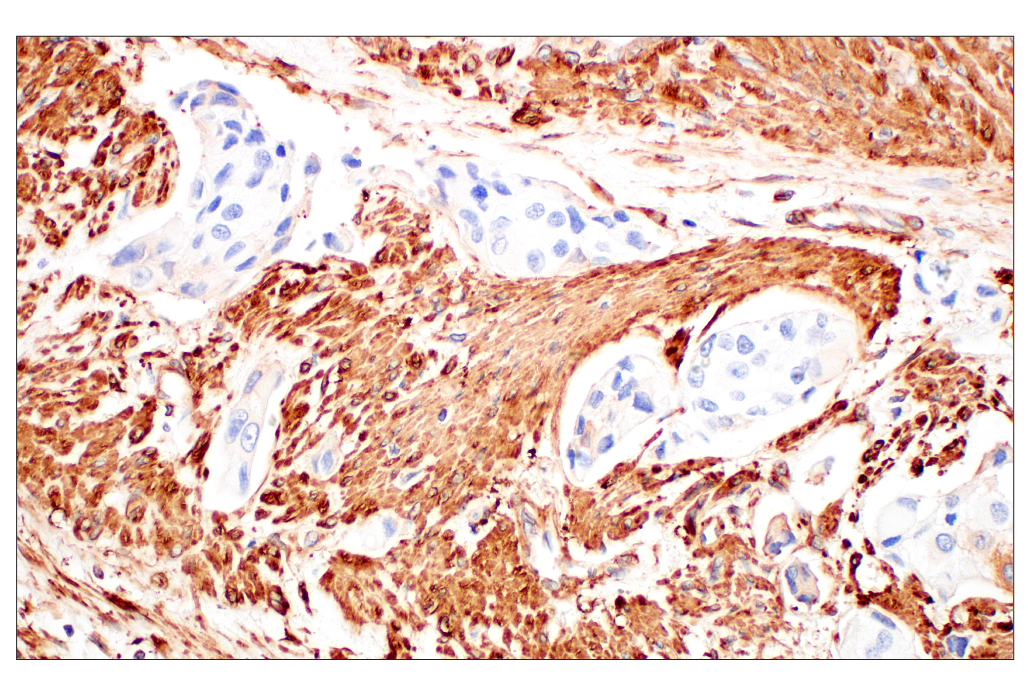 Immunohistochemistry Image 5: Filamin A (E8P8M) Rabbit mAb