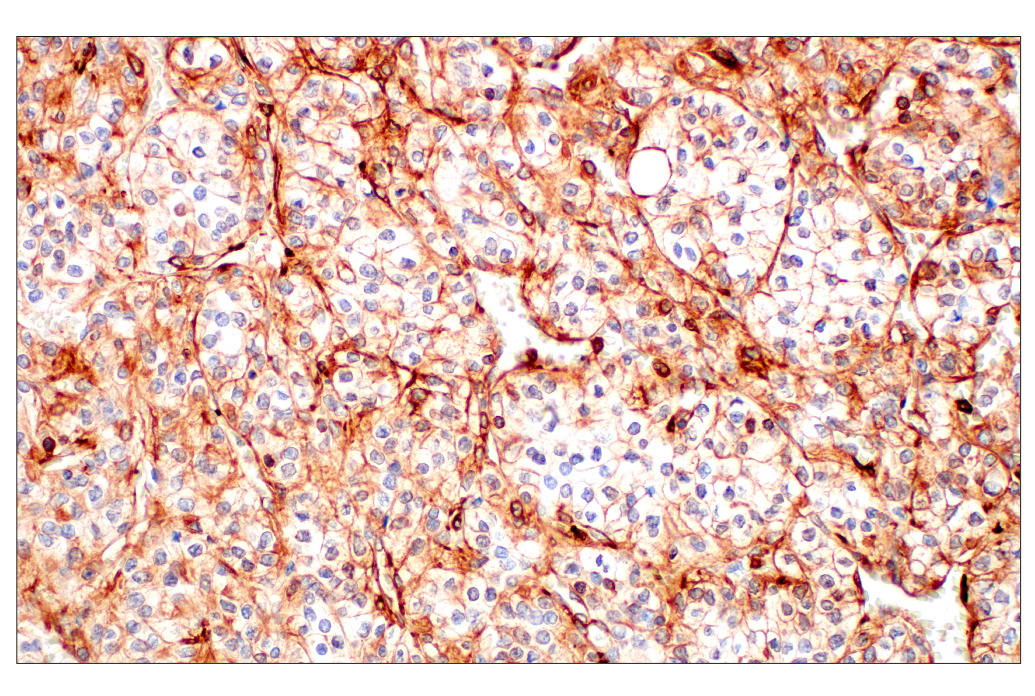 Immunohistochemistry Image 3: Filamin A (E8P8M) Rabbit mAb
