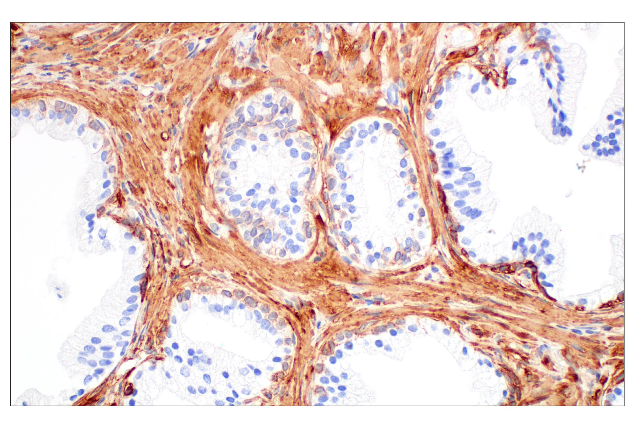Immunohistochemistry Image 8: Filamin A (E8P8M) Rabbit mAb