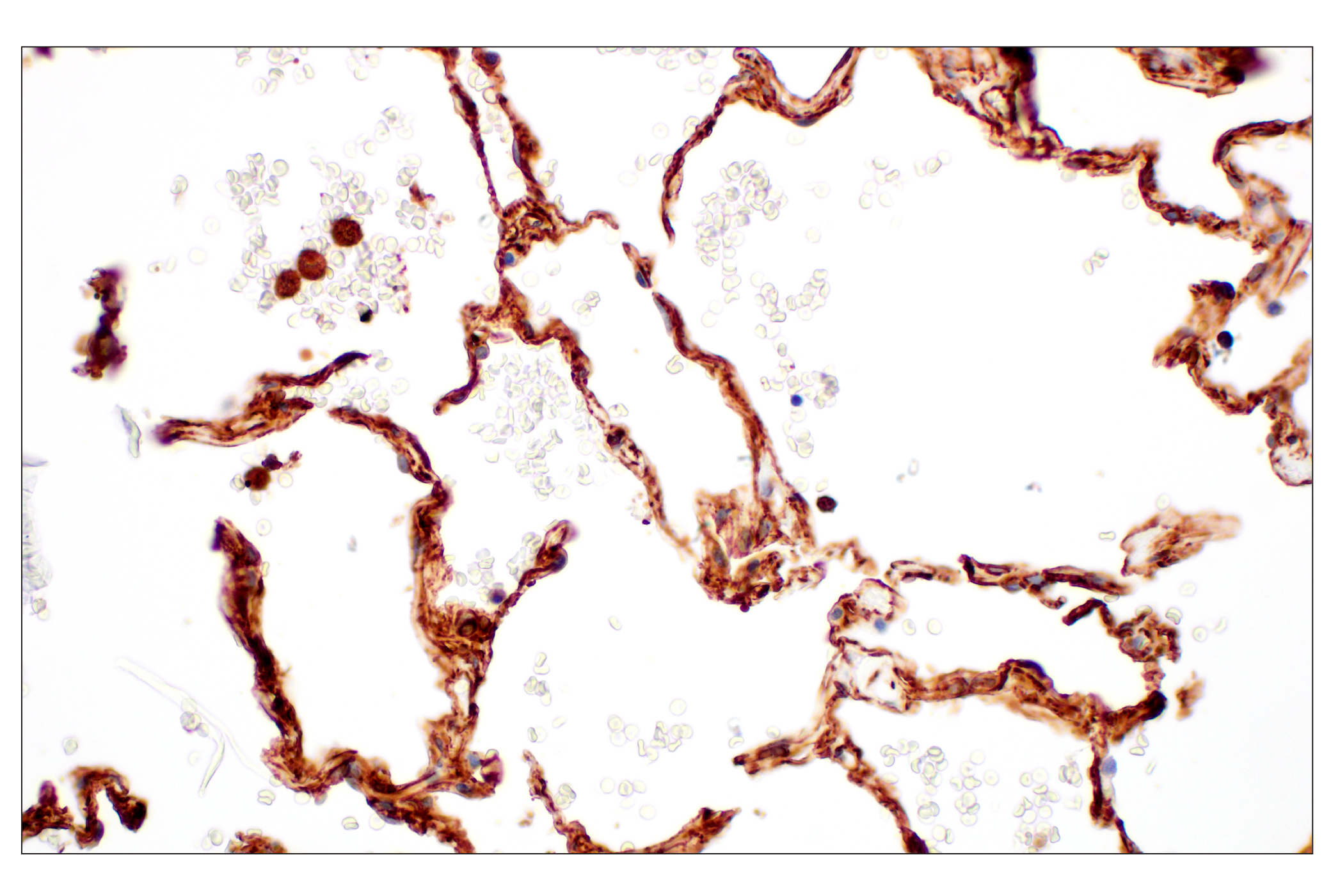 Immunohistochemistry Image 7: Filamin A (E8P8M) Rabbit mAb