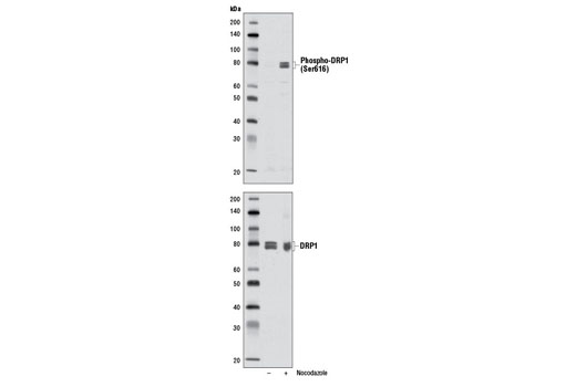  Image 5: Mitochondrial Dynamics Antibody Sampler Kit II