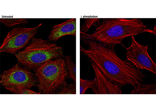 Immunofluorescence Image 1: Phospho-DRP1 (Ser616) (D9A1) Rabbit mAb