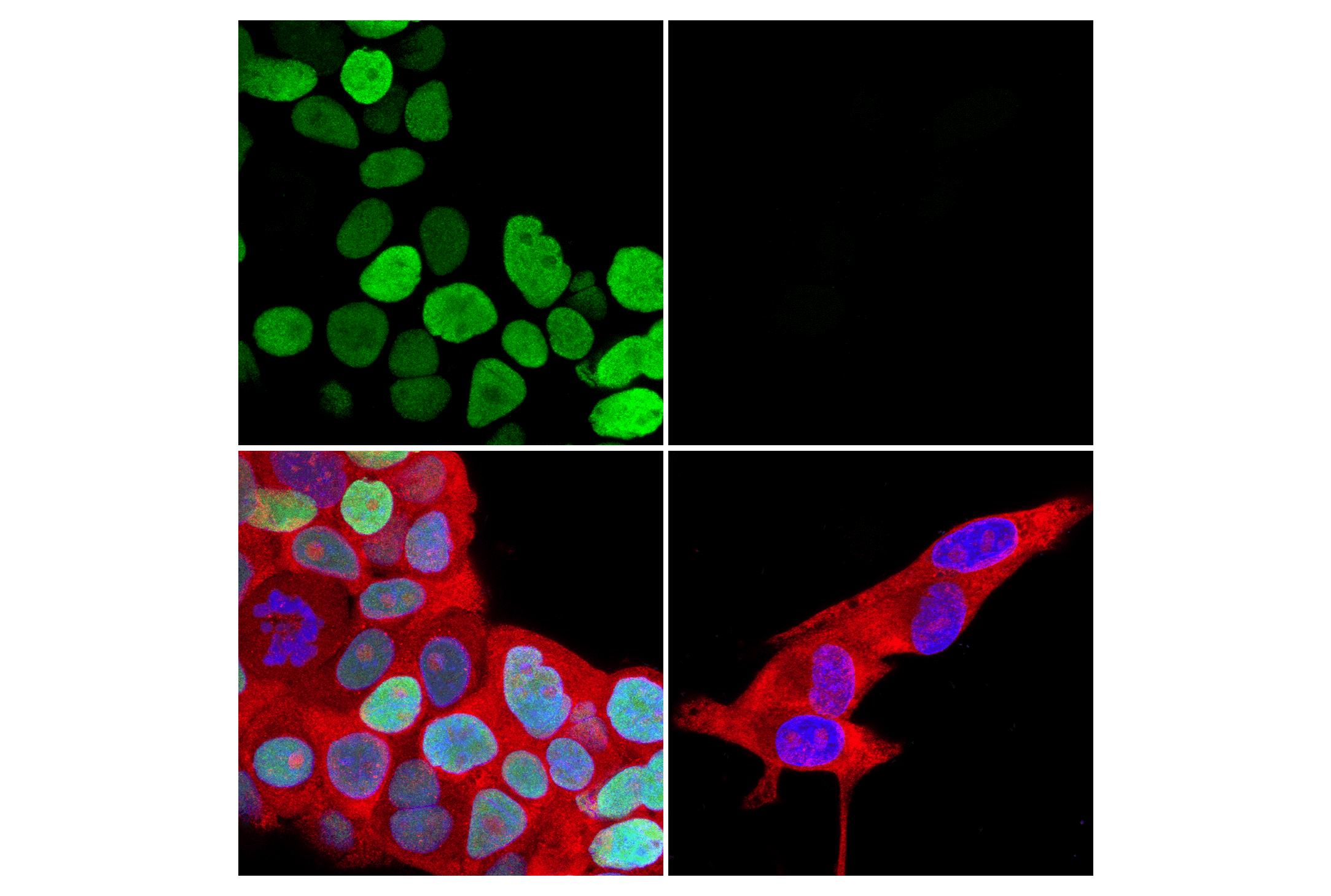 Immunofluorescence Image 1: FoxA1/HNF3α (E7E8W) Rabbit mAb (Alexa Fluor® 488 Conjugate)