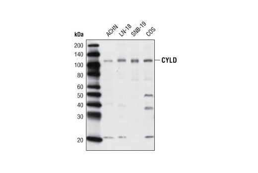 Western Blotting Image 1: CYLD Antibody