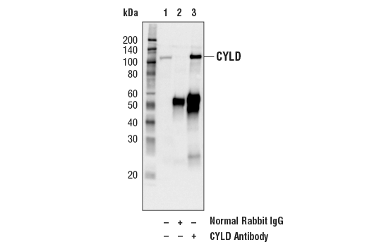 Immunoprecipitation Image 1: CYLD Antibody