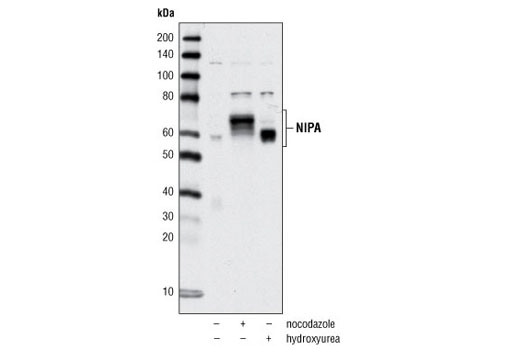 Western Blotting Image 1: NIPA Antibody