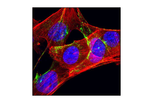 Immunofluorescence Image 4: Caveolin-1 (D46G3) XP® Rabbit mAb (BSA and Azide Free)