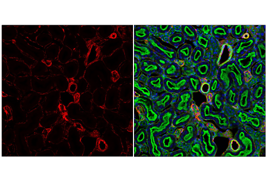 Immunofluorescence Image 2: Caveolin-1 (D46G3) XP® Rabbit mAb (BSA and Azide Free)