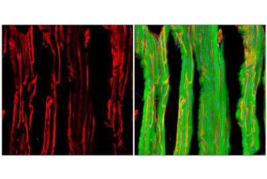 Immunofluorescence Image 3: Caveolin-1 (D46G3) XP® Rabbit mAb (BSA and Azide Free)