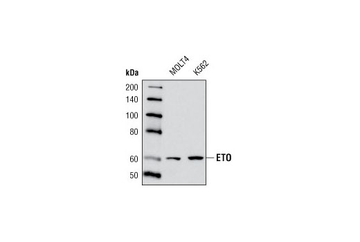 Western Blotting Image 1: ETO Antibody