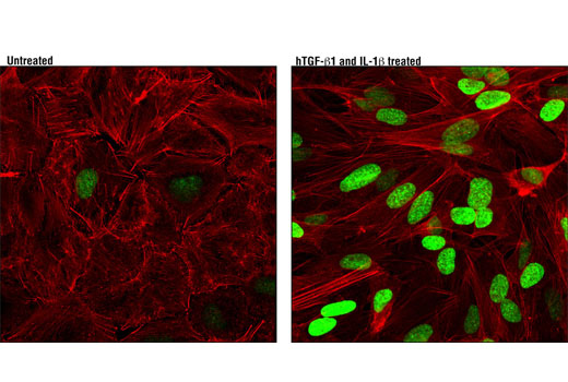 Immunofluorescence Image 1: HMGA2 (D1A7) Rabbit mAb (BSA and Azide Free)