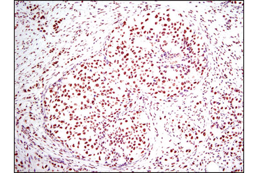 Immunohistochemistry Image 1: Histone H3 (D1H2) XP® Rabbit mAb