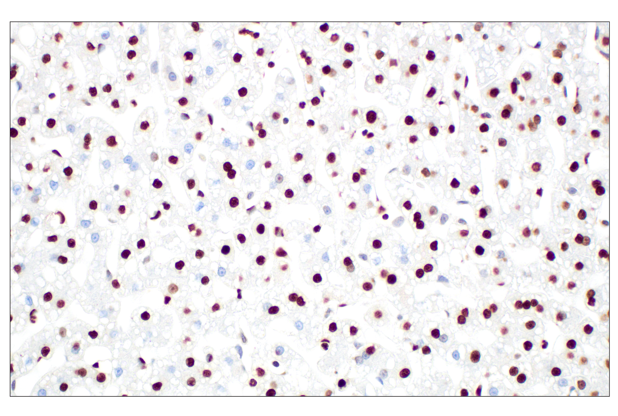  Image 28: Cell Fractionation Antibody Sampler Kit