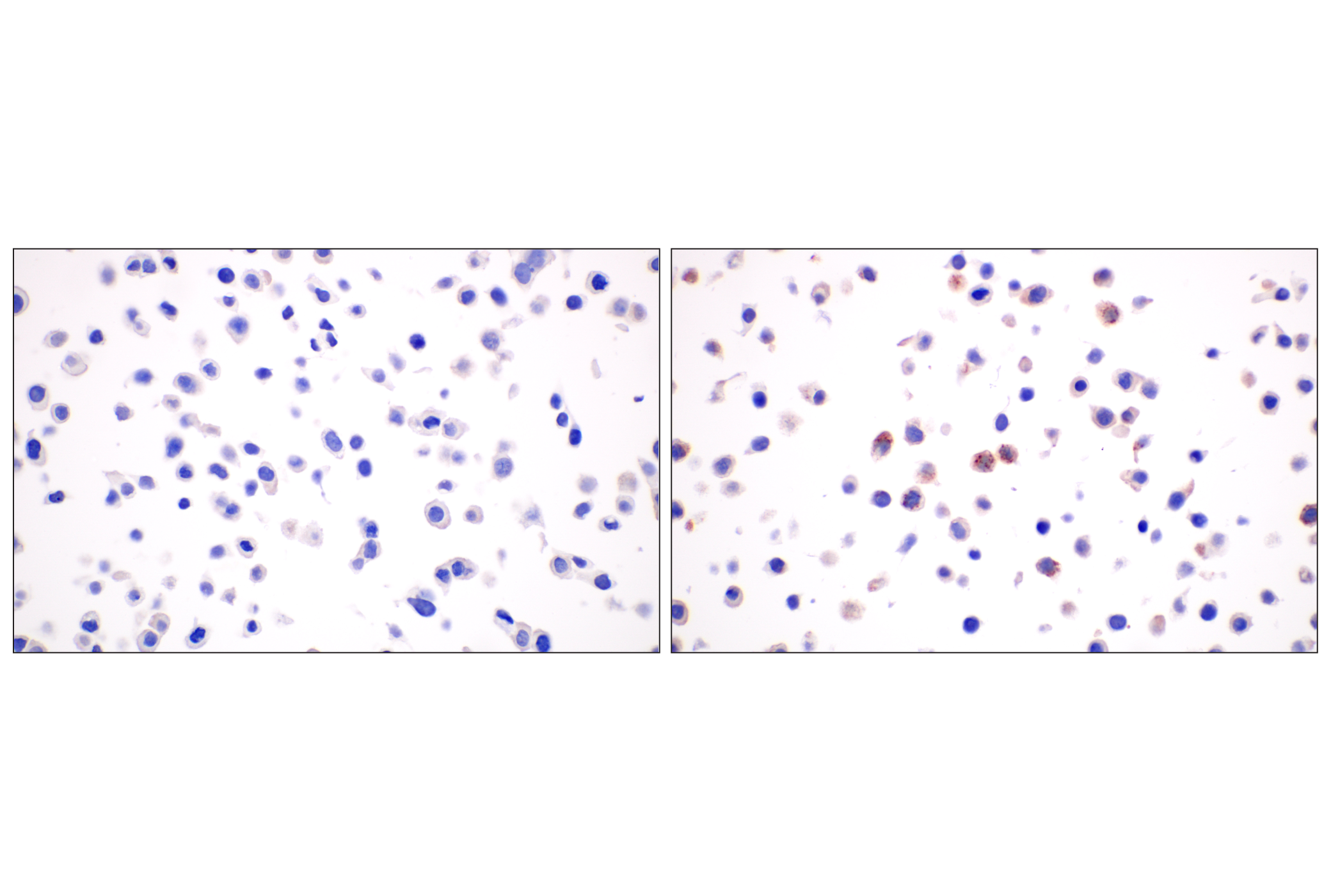 Immunohistochemistry Image 6: CXCL10 (F9N8I) Rabbit mAb