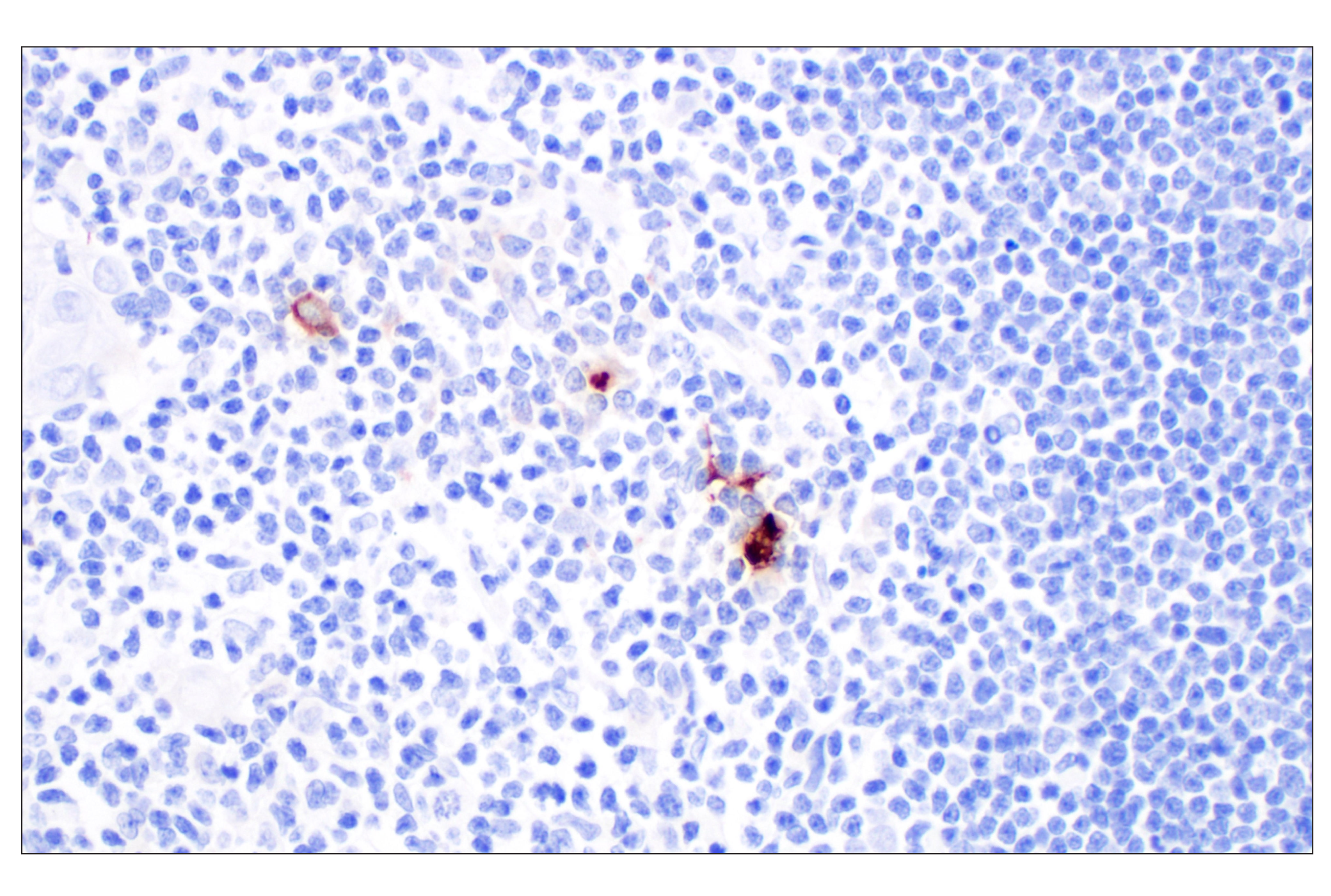 Immunohistochemistry Image 3: CXCL10 (F9N8I) Rabbit mAb