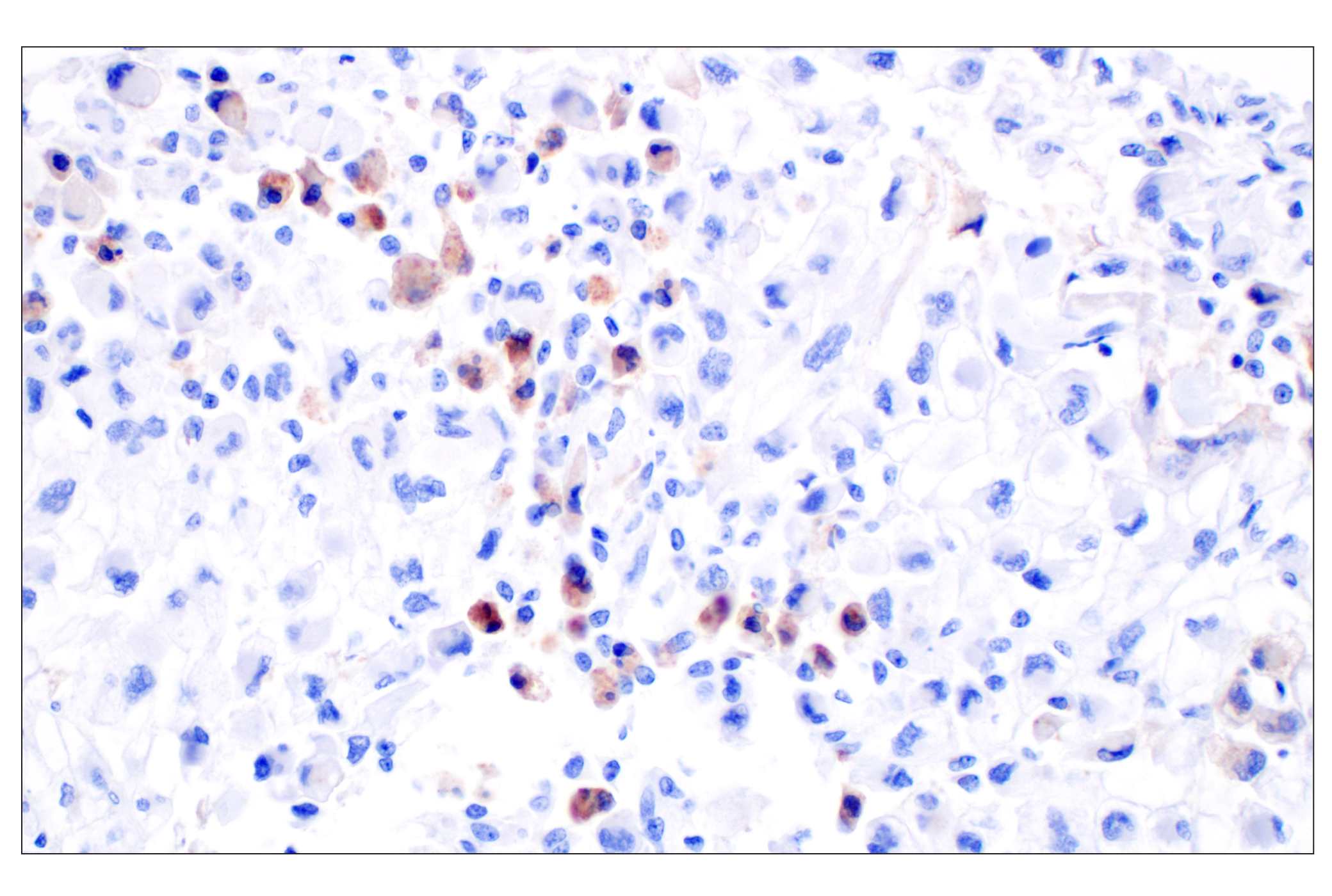 Immunohistochemistry Image 2: CXCL10 (F9N8I) Rabbit mAb