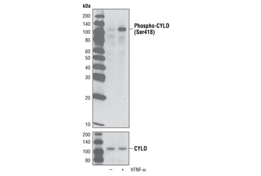 Western Blotting Image 1: Phospho-CYLD (Ser418) Antibody