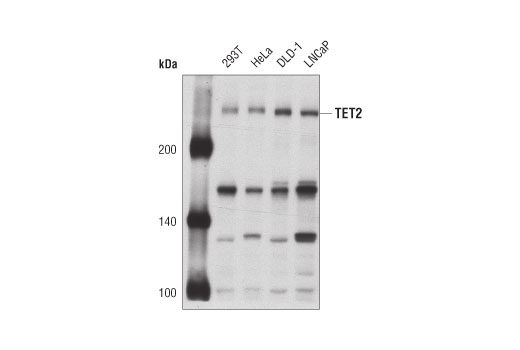Western Blotting Image 1: TET2 Antibody