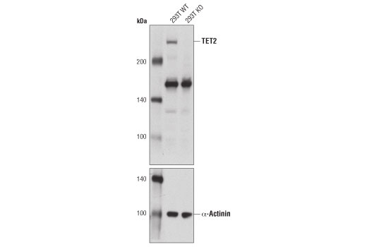Western Blotting Image 2: TET2 Antibody