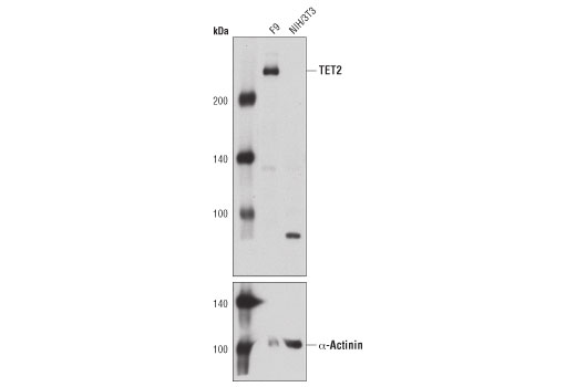 Western Blotting Image 3: TET2 Antibody