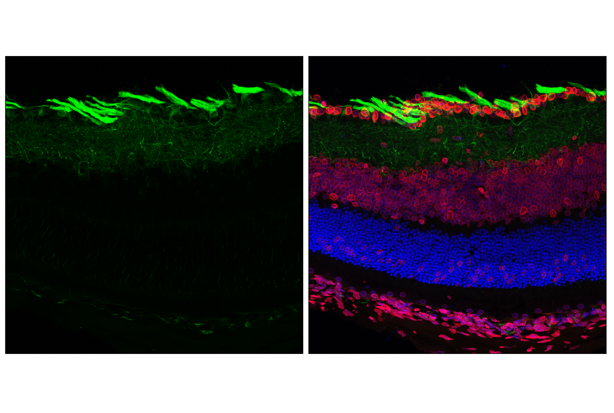 Immunofluorescence Image 1: β3-Tubulin (E9F3E) Mouse mAb