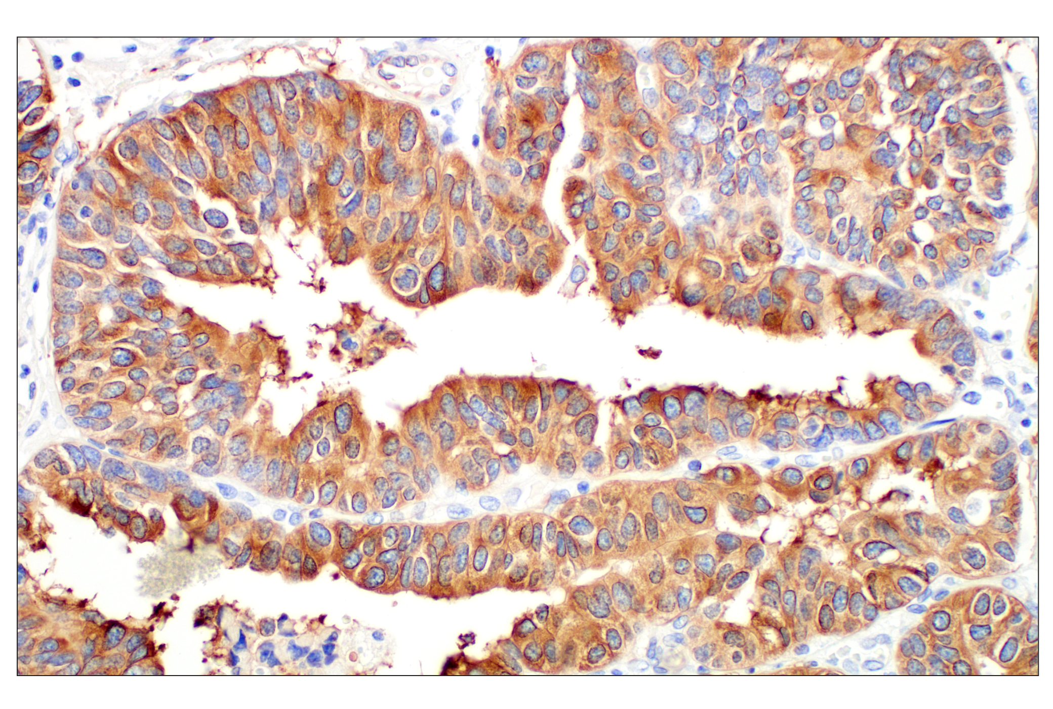 Immunohistochemistry Image 5: β3-Tubulin (E9F3E) Mouse mAb