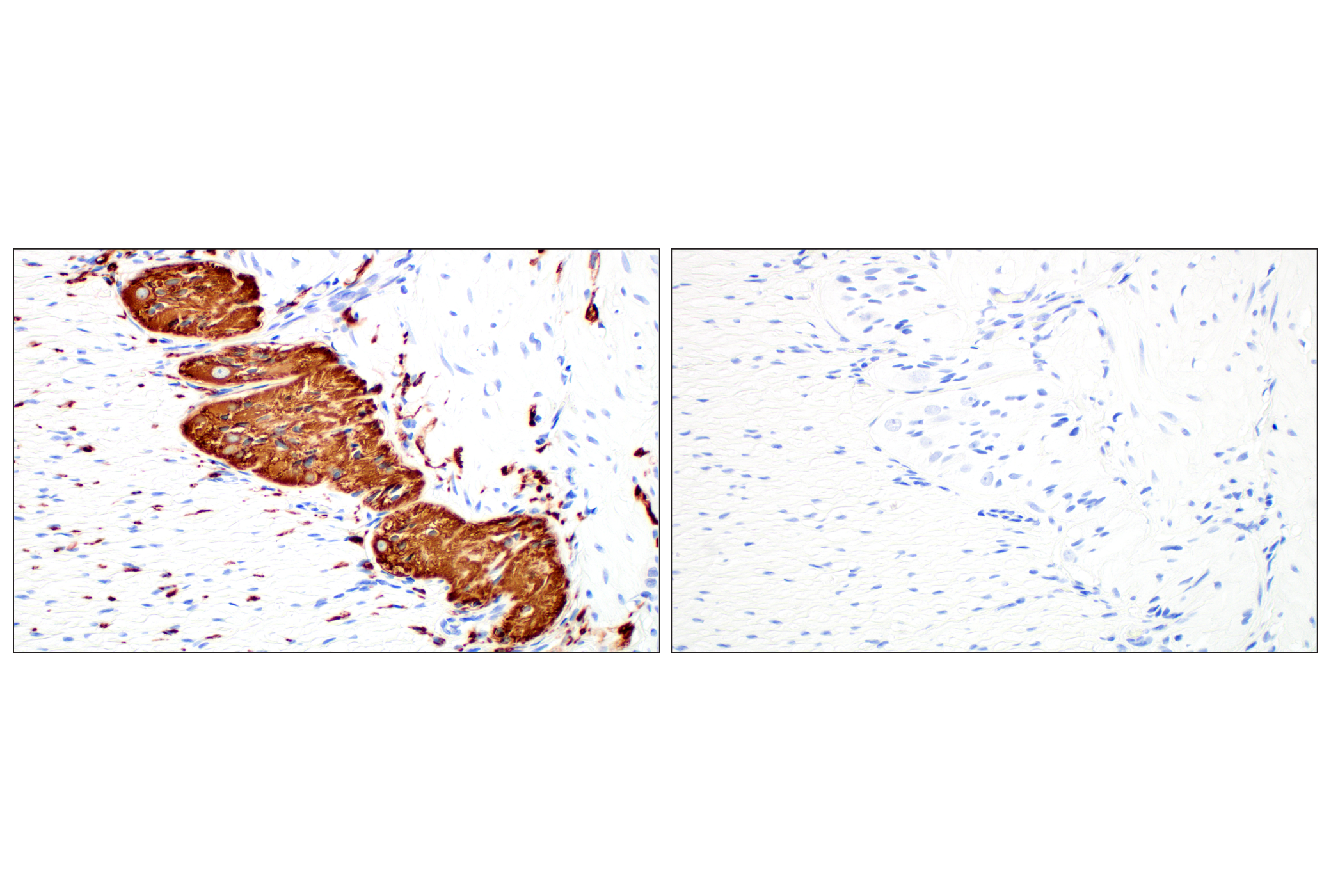 Immunohistochemistry Image 8: β3-Tubulin (E9F3E) Mouse mAb