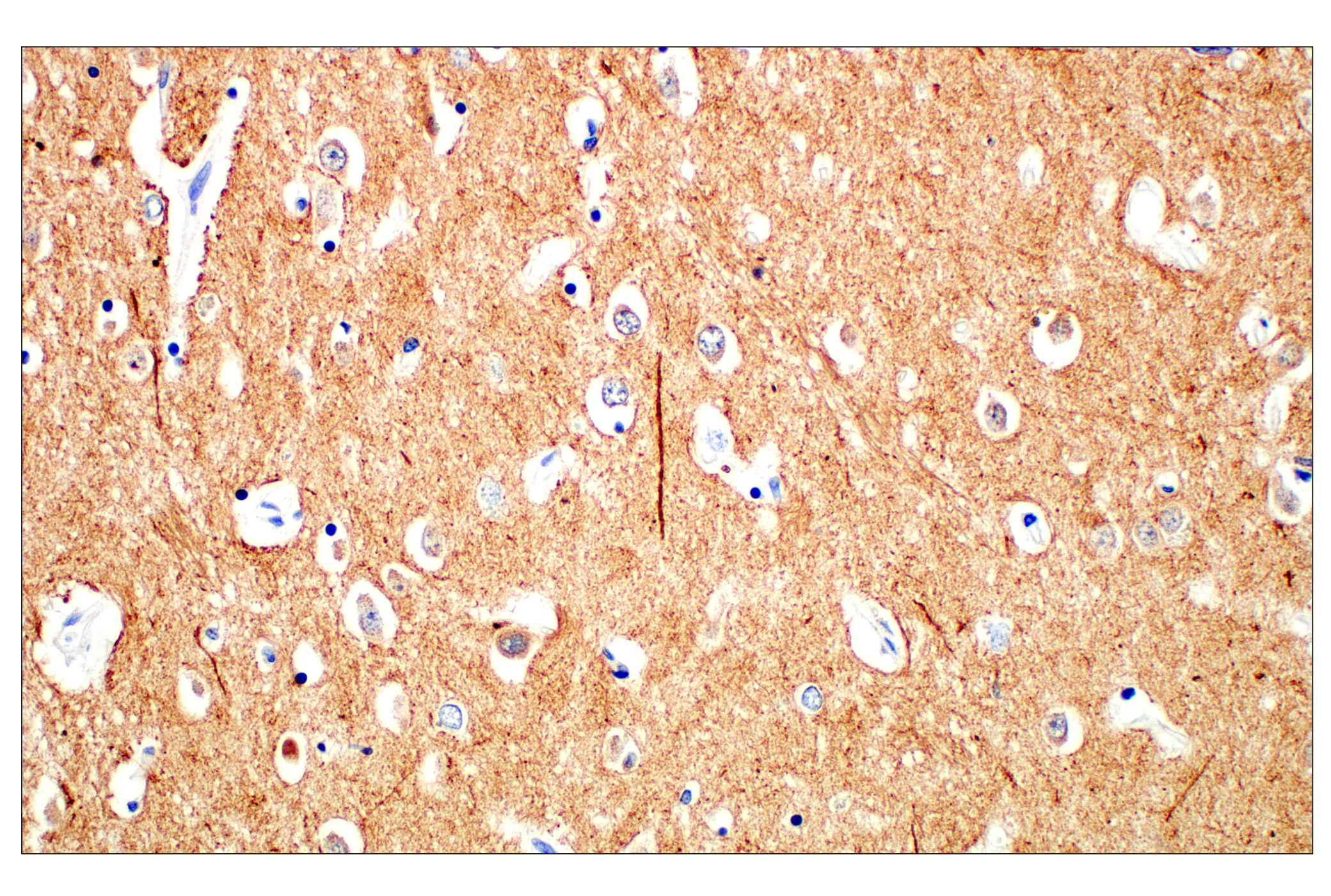 Immunohistochemistry Image 1: β3-Tubulin (E9F3E) Mouse mAb
