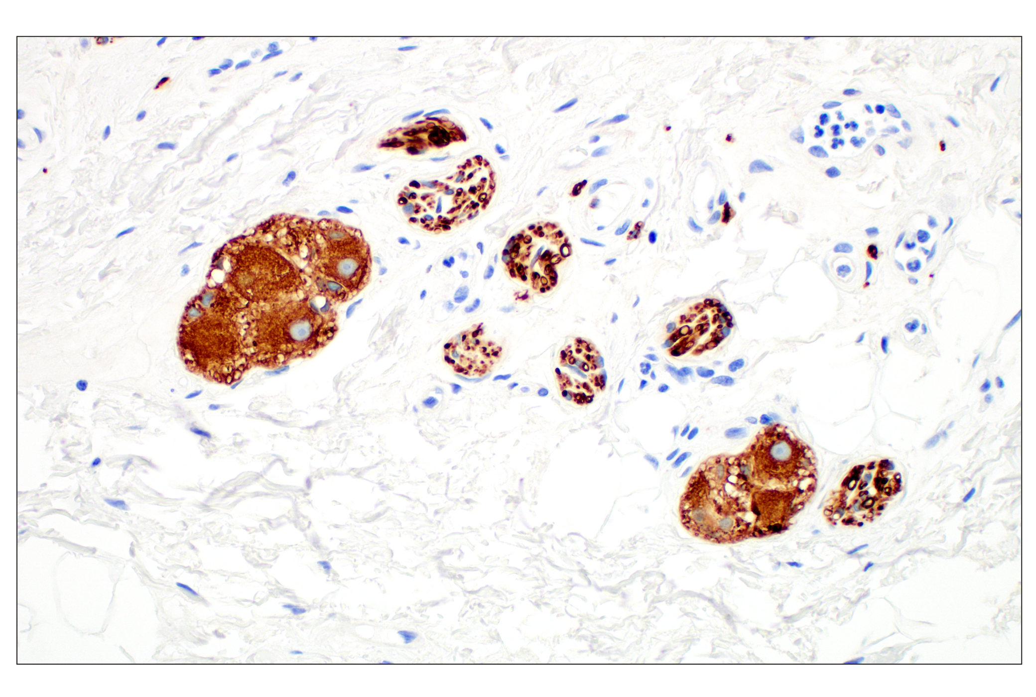 Immunohistochemistry Image 3: β3-Tubulin (E9F3E) Mouse mAb