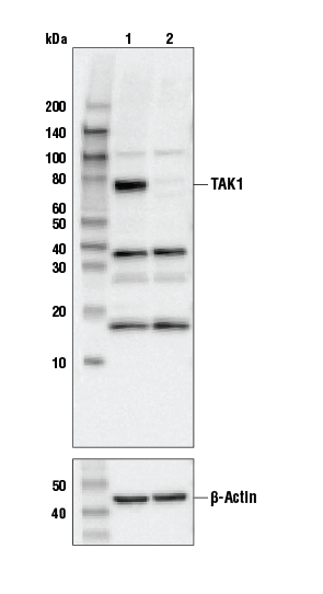 Western Blotting Image 1: TAK1 Antibody