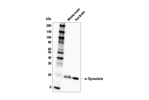 Western Blotting Image 1: α-Synuclein (E4U2F) XP® Rabbit mAb (BSA and Azide Free)