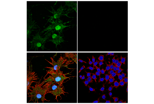 Immunofluorescence Image 3: α-Synuclein (E4U2F) XP® Rabbit mAb (BSA and Azide Free)