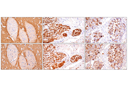 Immunohistochemistry Image 4: α-Synuclein (E4U2F) XP® Rabbit mAb (BSA and Azide Free)