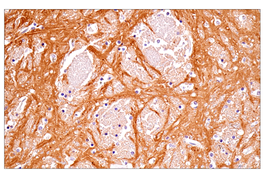 Immunohistochemistry Image 6: α-Synuclein (E4U2F) XP® Rabbit mAb (BSA and Azide Free)