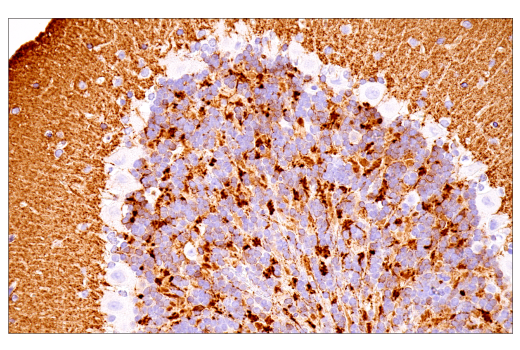 Immunohistochemistry Image 9: α-Synuclein (E4U2F) XP® Rabbit mAb (BSA and Azide Free)