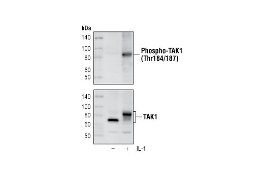 Phospho-TAK1 (Thr184/187) (90C7) Rabbit mAb | Cell Signaling 