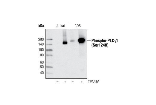 Western Blotting Image 1: Phospho-PLCγ1 (Ser1248) Antibody