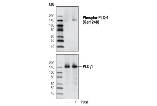 Western Blotting Image 2: Phospho-PLCγ1 (Ser1248) Antibody