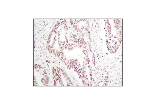 Immunohistochemistry Image 1: Phospho-p38 MAPK (Thr180/Tyr182) (D3F9) XP® Rabbit mAb